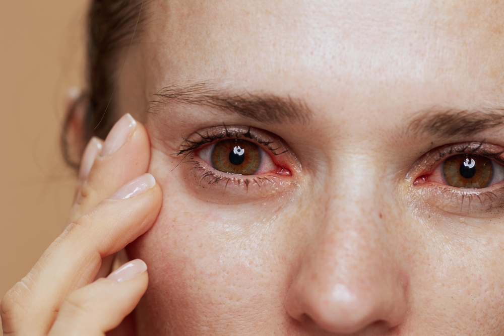 What Are the Early Stages of Dry Eye and How Can You Recognize Them? What Are the Early Stages of Dry Eye and How Can You Recognize Them?