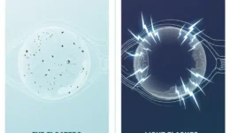 Medical illustration comparing eye floaters and flashes, showing dark drifting specks in the vitreous and lightning-like flashes near the retina that may signal a retinal emergency.